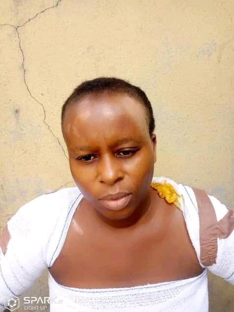 ane Amos vows not to withdraw case against police inspector who threw a burning stove at her in their residence in P/ Harcourt