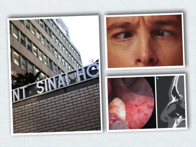 Mount Sinai Hospital shock find- tooth growing in the nostril