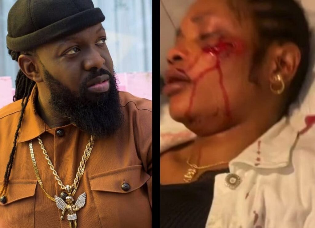 Timaya and the injured lady
