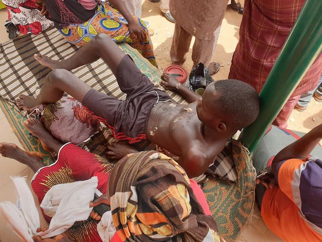 One of the victims of the bomb blast in Taraba