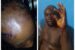 Stanley and Comfort Nwagadi with the injuries inflicted on them with cutlass by Alabo, their landlord in Port Harcourt