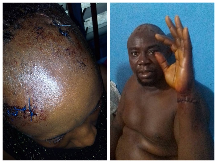 Stanley and Comfort Nwagadi with the injuries inflicted on them with cutlass by Alabo, their landlord in Port Harcourt