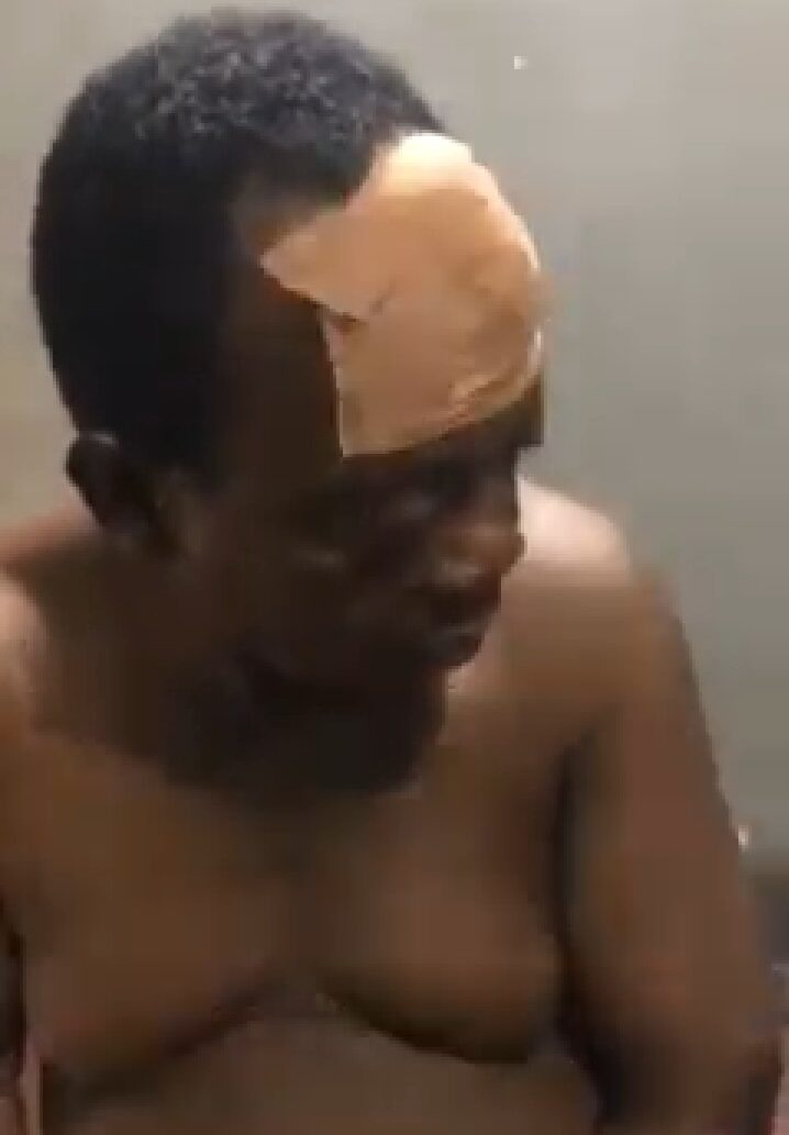 Mr Mr. Anthony Jibunor, the trader attacked with cutlass by the mad man' the popular New Benin market who was rescued from being lynched by an angry mob