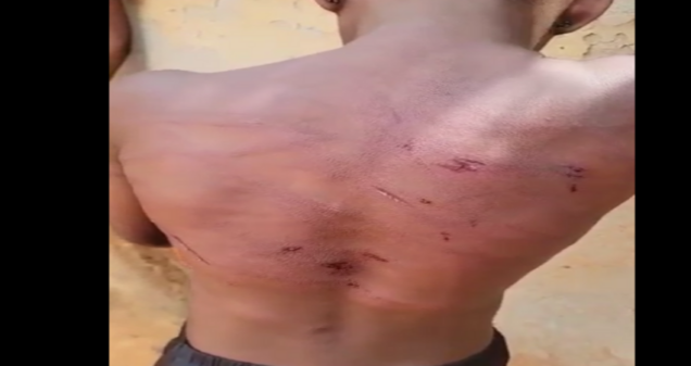 10-year old girl, Oluebibe Emmanuel with signs of maltreatment on her back by  Nweke Chadikaobi