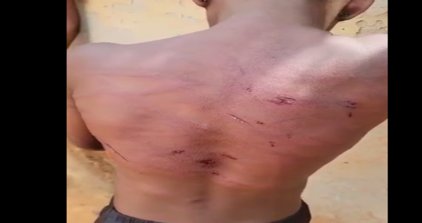 10-year old girl, Oluebibe Emmanuel with signs of maltreatment on her back by Nweke Chadikaobi
