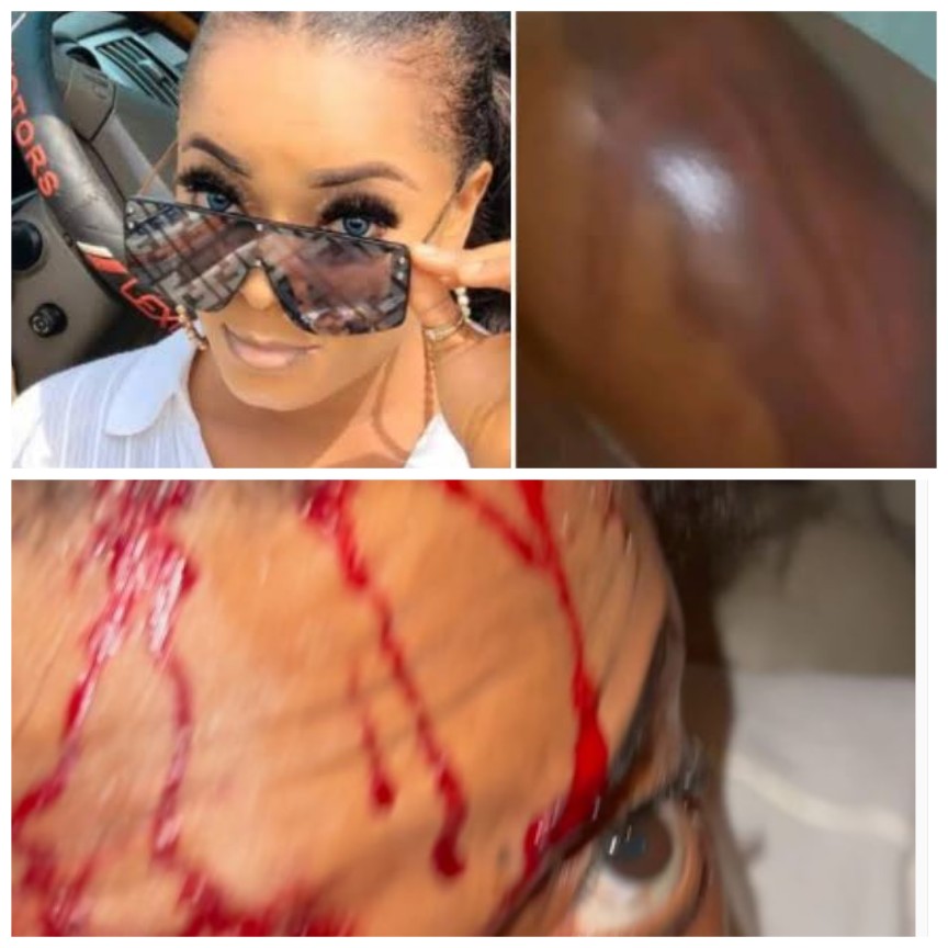 Actress Helen Duru bleeds, accuses EFCC operatives