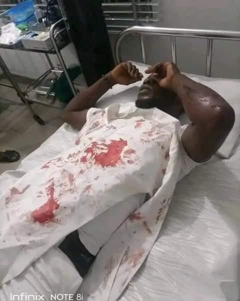 Nwankwoala Udo, lying ill is a strong supporter of Atiku Abubakar in Omuma Local Government Area of Rivers State was attacked along side other supporters.