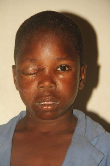 Police hunt for culprits who plucked the eye of Najib Hussaini, a 12-year-old student of Arabic school in Bauchi state.