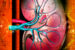 Kidney disease