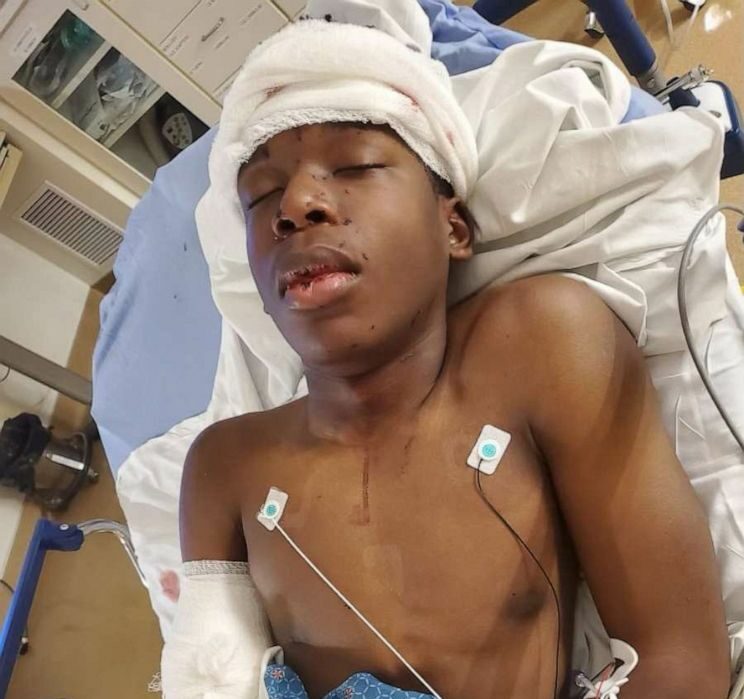 84-year-old white Kansas City man charged for shooting Black teen