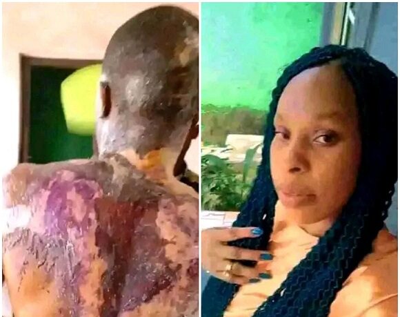 Police arrest Rivers housewife Hope Nwala for allegedly pouring hot vegetable oil on her husband, Ekelediri Nwankwo, while he was asleep