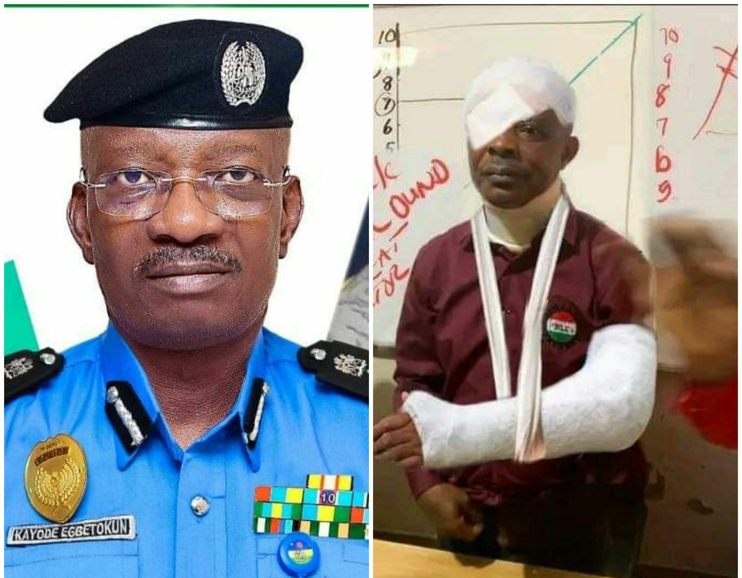 IGP Kayode Egbetokun deploys DIG CID to investigate alleged assault on the President of NLC, Comrade Joe Ajaero in Owerri, Imo State