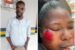 Police arrest Lagos man Olamilekan Morekeji, for beating, using big stone to injure ex-wife, Mary Ololuwa, causing serious injuries to her