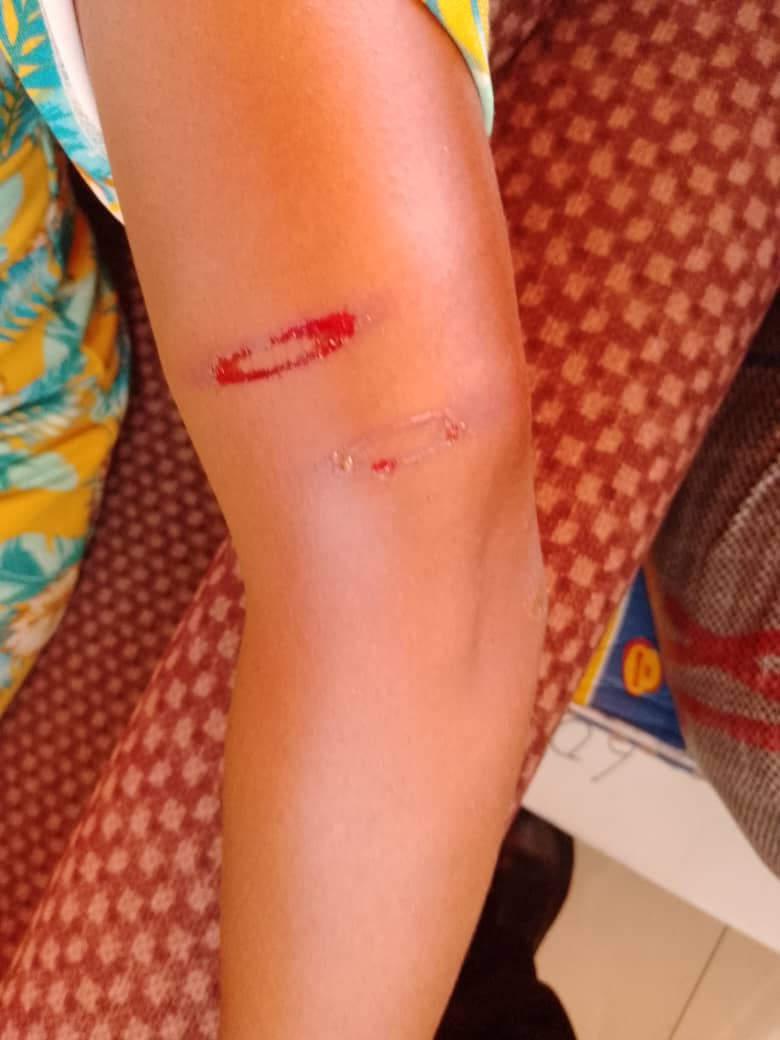 Pandemonium in Port Harcourt as members of a student's family invade school, assault teacher, one other for allegedly flogging their child.