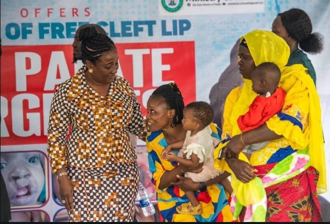 20 children benefit from free cleft lip and palate surgery during Edo medical outreach at the Edo Specialist Hospital (ESH), in Benin City.