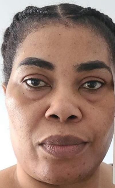 NIDCOM CEO, Abike Dairi- Erewa identifies who vowed to start poisoning Yoruba and Benin people in Canada as Amaka Patience Sunnberger.