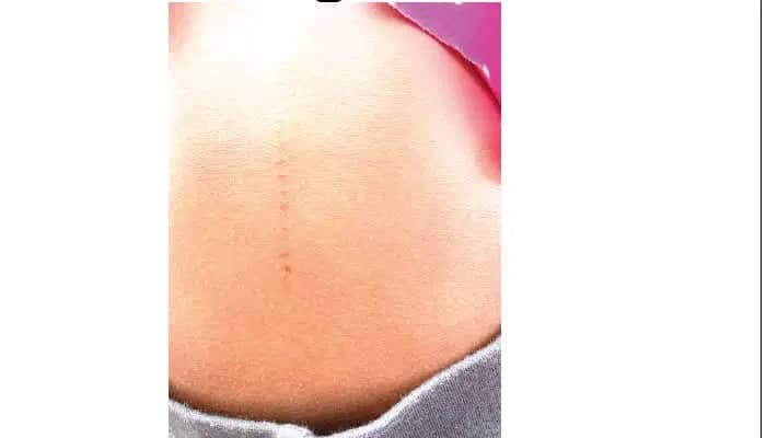 "Incisions not from our school, a desperate attempt to tarnish our name" - Ogun school refutes allegations of incisions on pupils' bodies