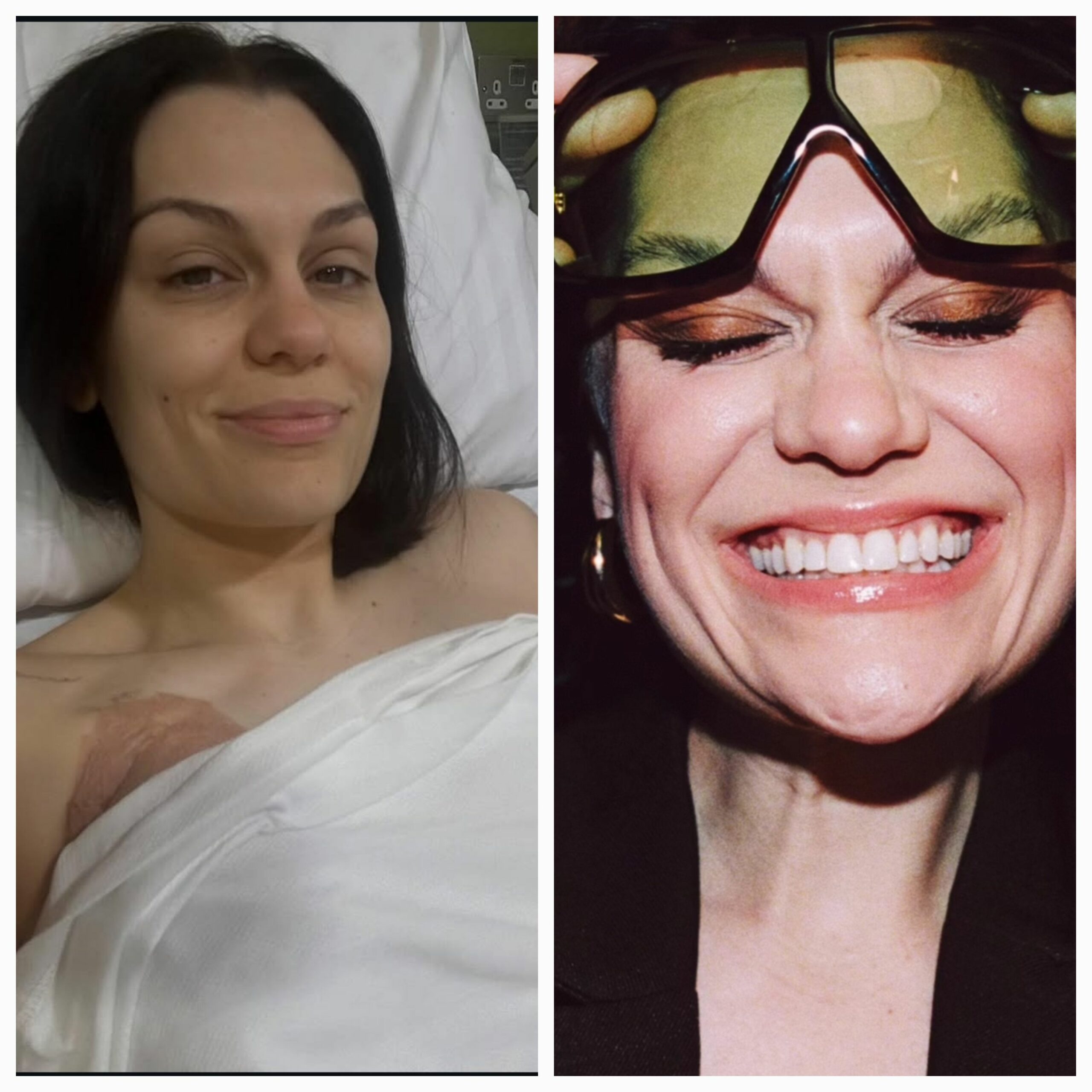 Jessie J opens up about battle with breast cancer