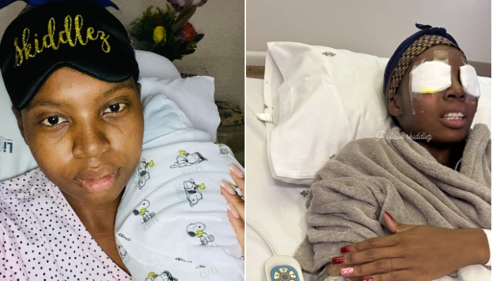 How South African woman suffered temporary blindness from lash extension