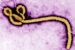 Ebola
