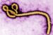 Ebola
